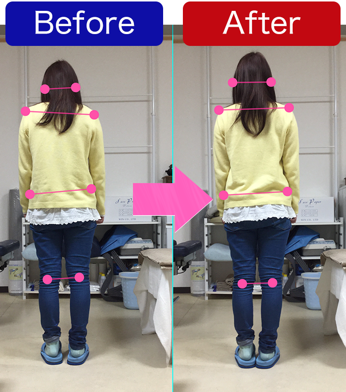 姿勢解析　立位背面比較