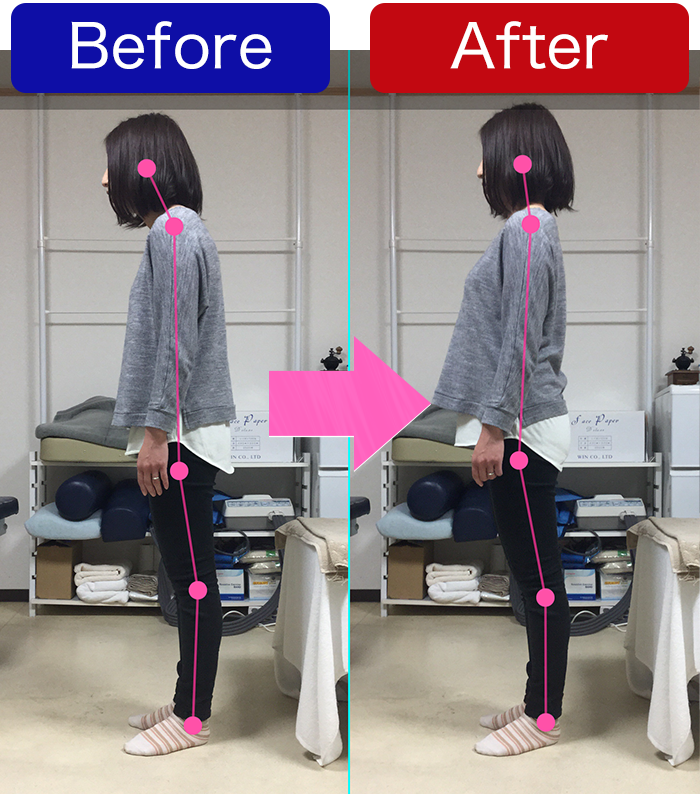 姿勢解析　立位側面比較